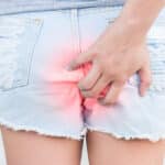 hämorrhoiden symptome frau