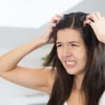 hausmittel gegen schuppen bei frauen