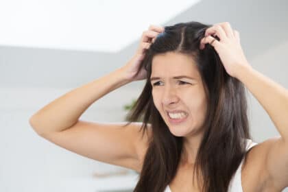 hausmittel gegen schuppen bei frauen