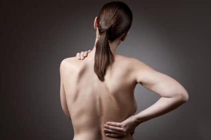 morbus bechterew symptome bei frauen